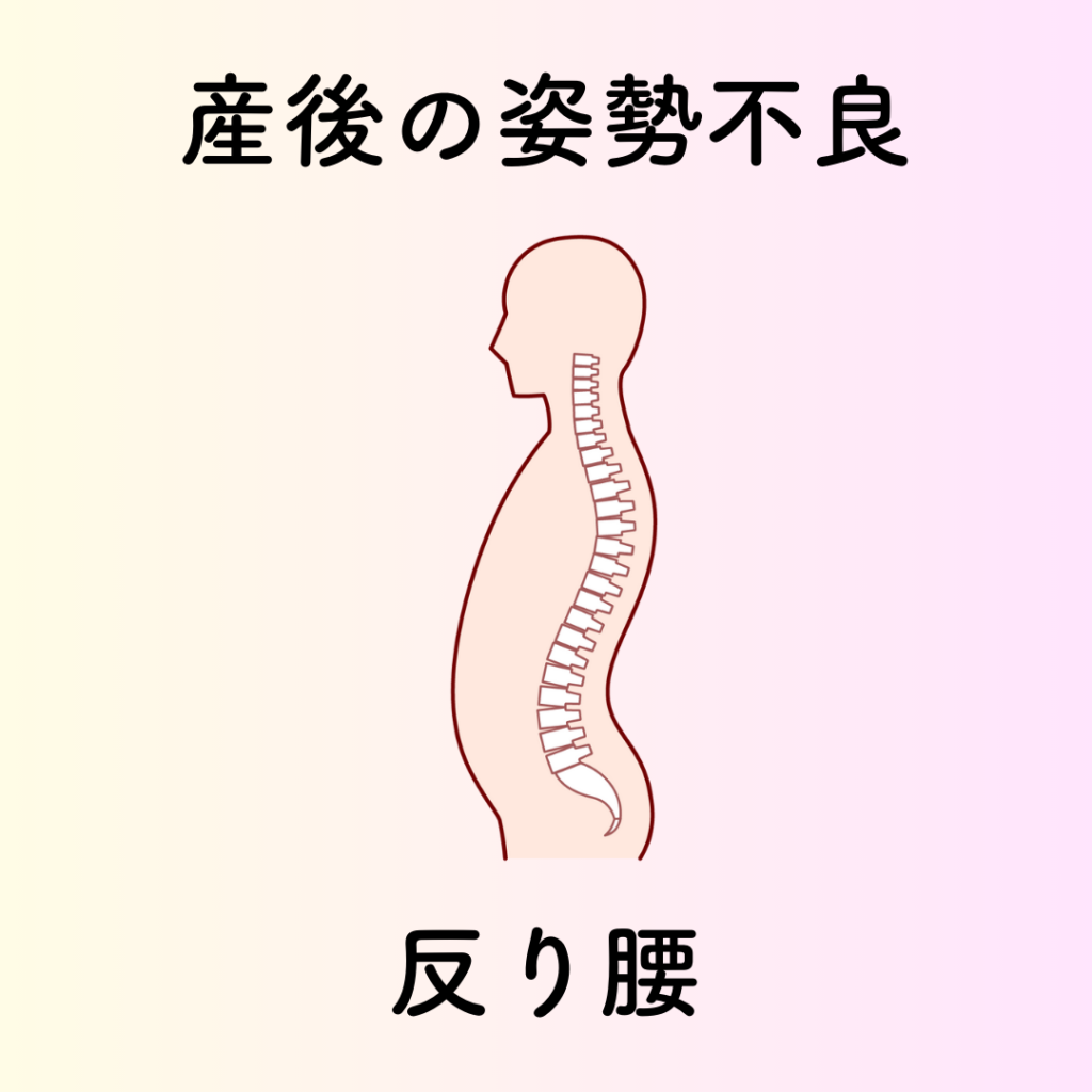 産後の姿勢不良