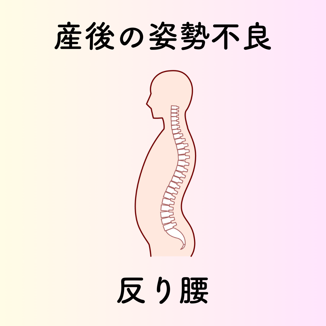 産後の姿勢不良
