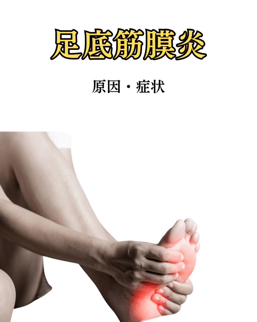 池田市のHALU鍼灸整骨院で足底筋膜炎改善を目指す津崎先生